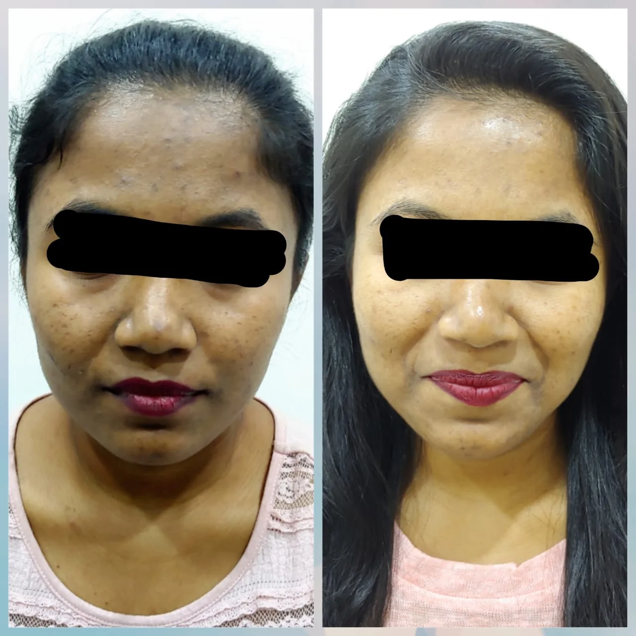 WhatsApp-Image-2022-06-28-at-12.45.24-PM